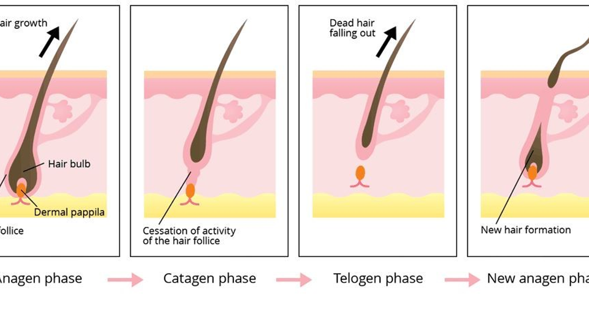 Можно ли удалять волосы лазером. Первая фаза: анаген. Фазы роста волос анаген. Анаген катаген телоген. Телоген электроэпиляция.